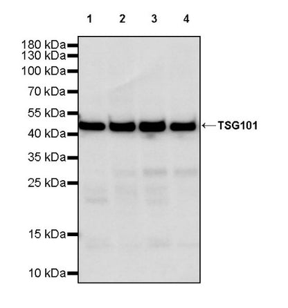 TSG101 Recombinant Rabbit mAb (S-1868-76)