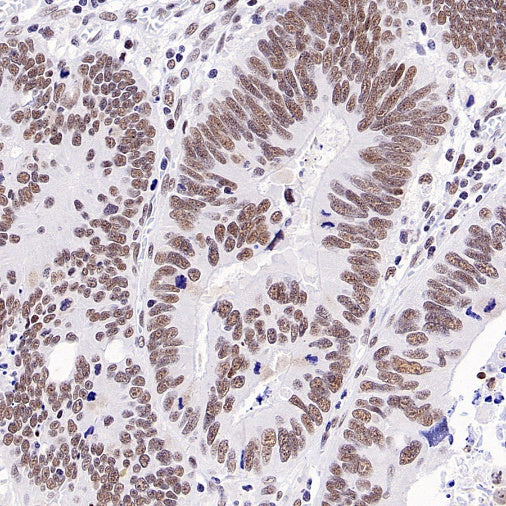 TEL1 Recombinant Rabbit mAb (S-3067-60)