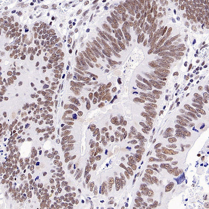 TEL1 Recombinant Rabbit mAb (S-3067-60)