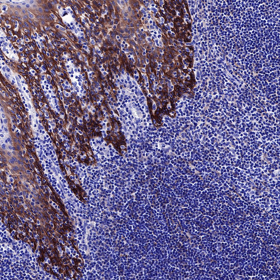 EGFR Recombinant Rabbit mAb (SDT-R110)