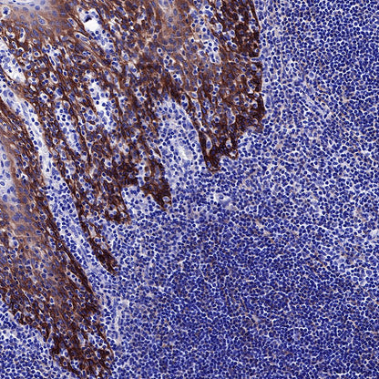 EGFR Recombinant Rabbit mAb (SDT-R110)