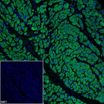 MYH7 Recombinant Rabbit mAb (S-4468-32)