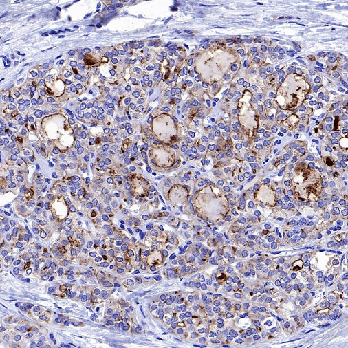 DPP4 Recombinant Rabbit mAb (S-1631-130)