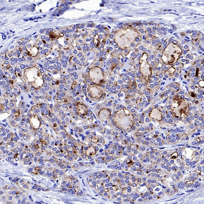 DPP4 Recombinant Rabbit mAb (S-1631-130)