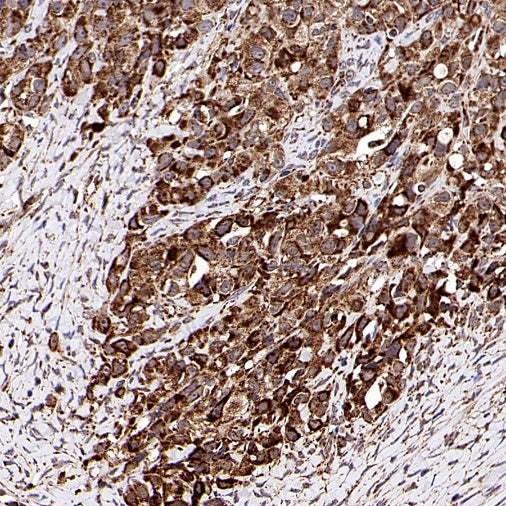 Fumarate hydratase Recombinant Rabbit mAb (SDT-2434-37)