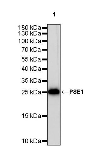 PSME1 Recombinant Rabbit mAb (S-732-14)