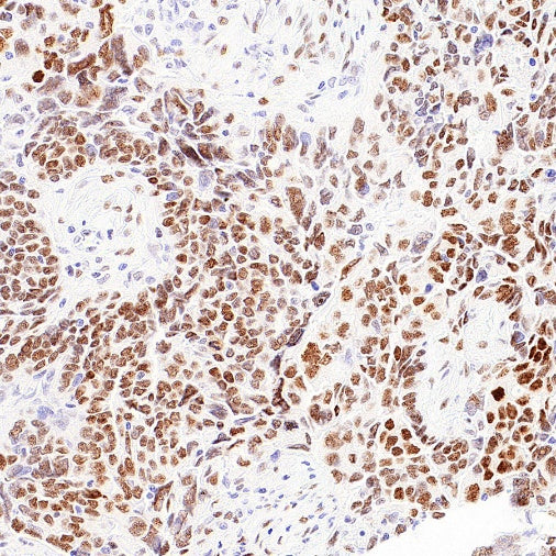FOXP4 Recombinant Rabbit mAb (S-6198)