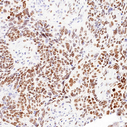FOXP4 Recombinant Rabbit mAb (S-6198)