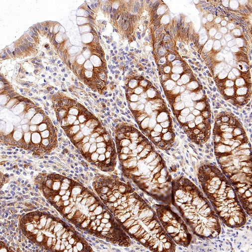 TIM-1 Recombinant Rabbit mAb (S-1555-147)