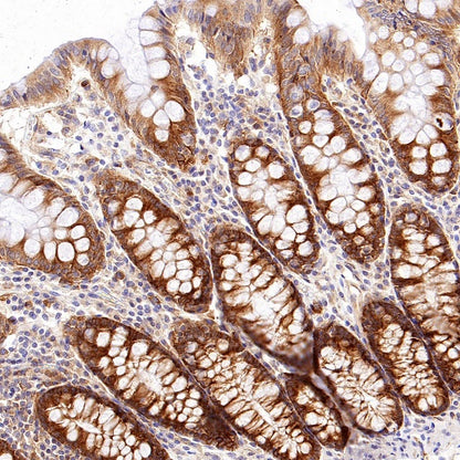 TIM-1 Recombinant Rabbit mAb (S-1555-147)