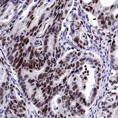 DLX5 Recombinant Rabbit mAb (S-2785-79)