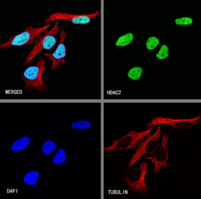 HDAC2 Recombinant Rabbit mAb (S-1474-27)