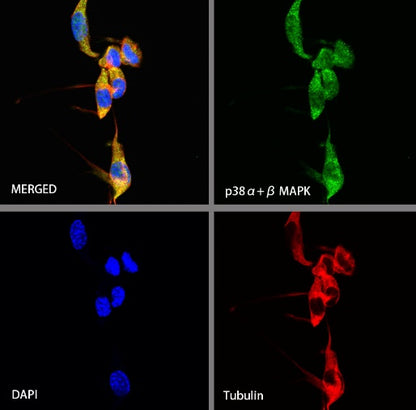 p38α MAPK+p38β MAPK Recombinant Rabbit mAb (S-1300-102)