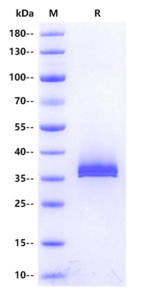 Human DcR3 Protein, His Tag