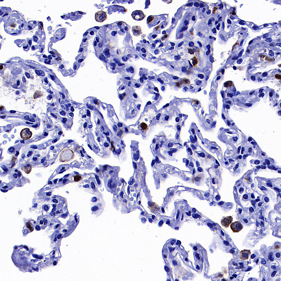 uPAR/CD87 Recombinant Rabbit mAb (S-3960-82)