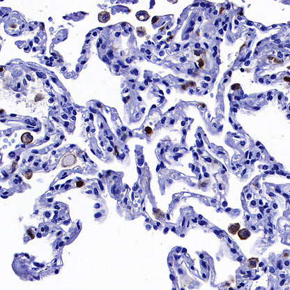 uPAR/CD87 Recombinant Rabbit mAb (S-3960-82)