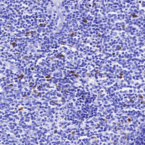 Kappa light chain Recombinant Rabbit mAb (S-385-23)
