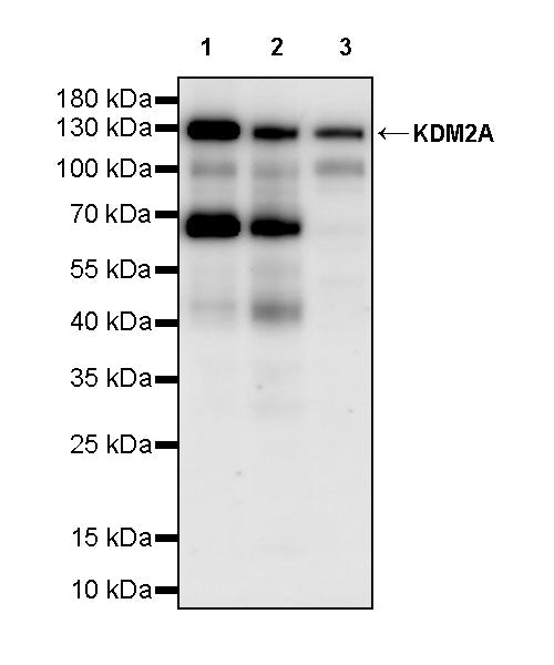 KDM2A Recombinant Rabbit mAb (S-3943-25)