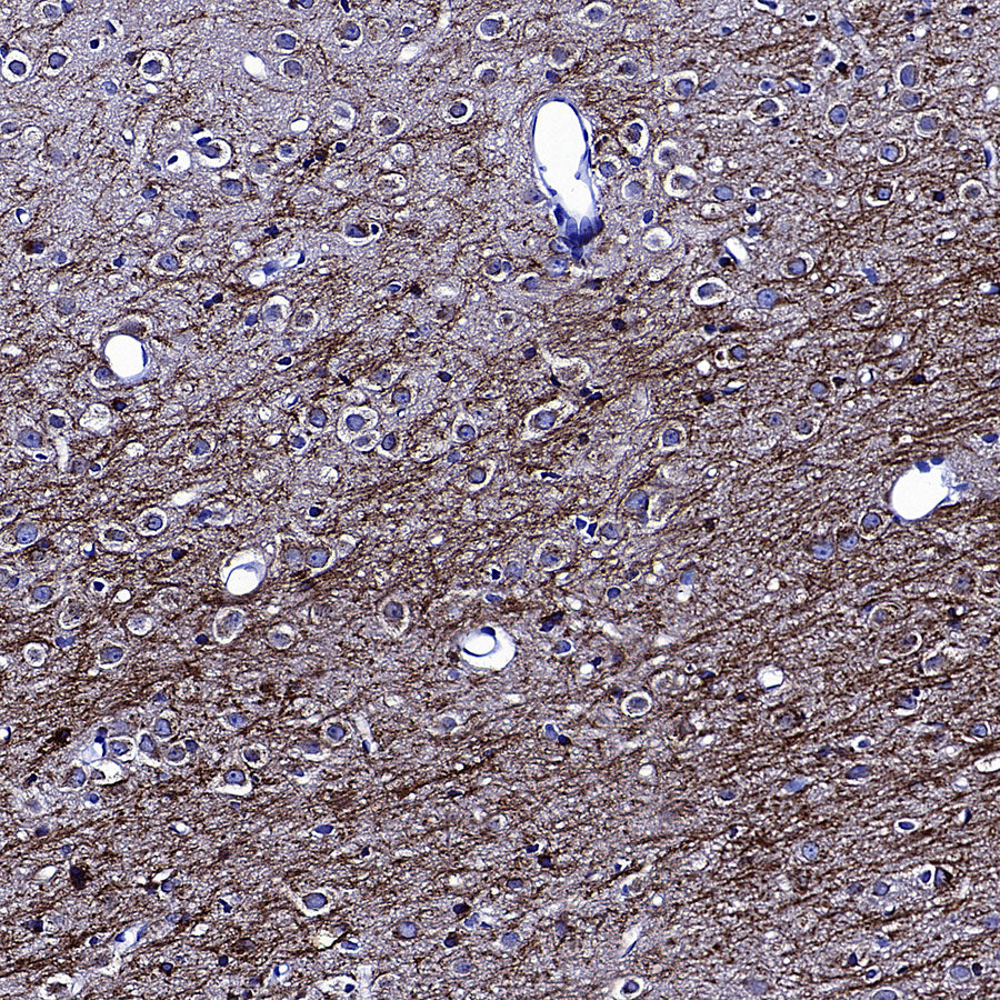 APP Recombinant Rabbit mAb