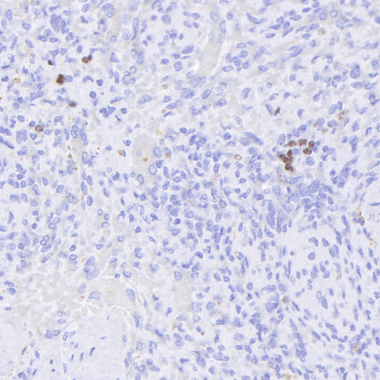 S-RMab® Ki67 Recombinant Rabbit mAb (SDT-R459)