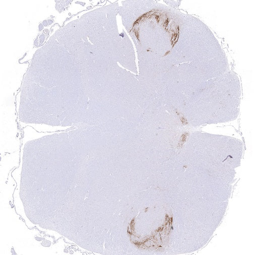 CGRP Recombinant Rabbit mAb (S-2490-74)