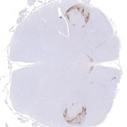 CGRP Recombinant Rabbit mAb (S-2490-74)