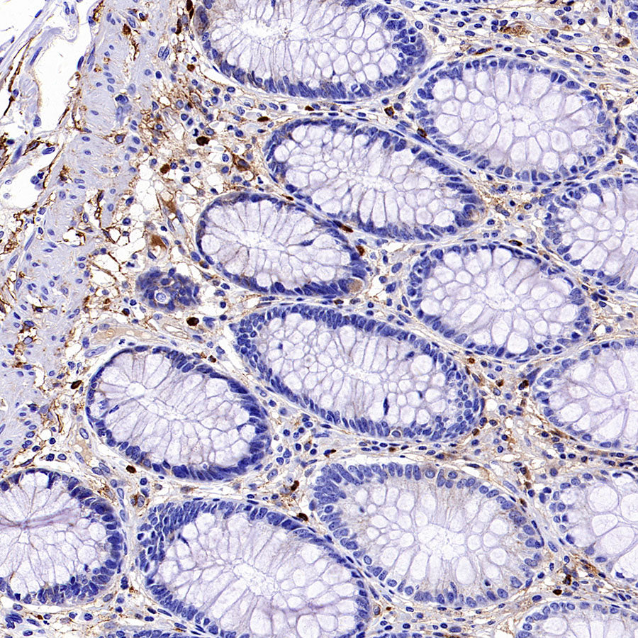 PTK7 Recombinant Rabbit mAb ,PBS Only(SDT-2432-156)