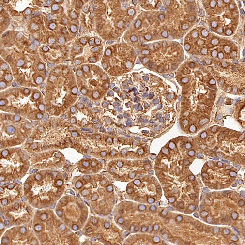 Beta IV Tubulin Rabbit polyclonal antibody