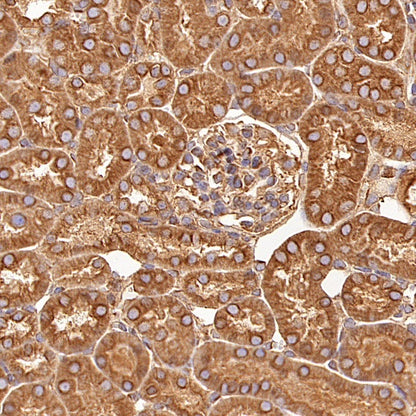 Beta IV Tubulin Rabbit polyclonal antibody