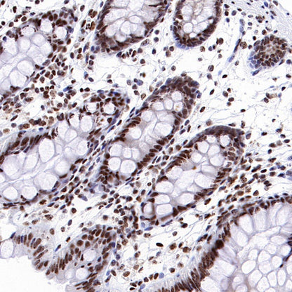 SUMO-1 Recombinant Rabbit mAb (S-625-111)