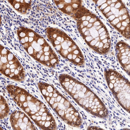 Caspase-7 Recombinant Rabbit mAb (S-R254)