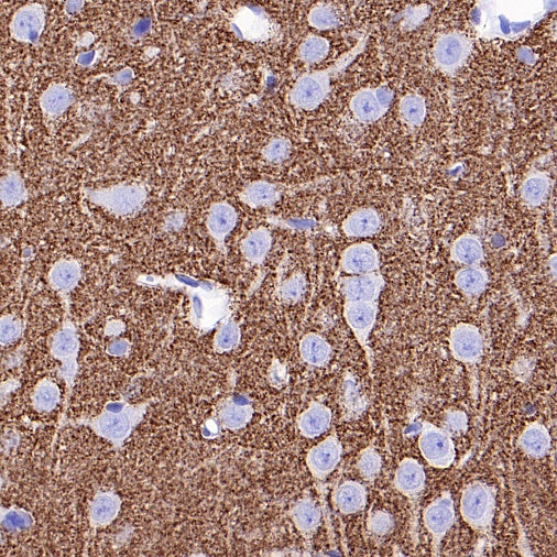 Vesicular Glutamate Transporter 1 (VGLUT1) Recombinant Rabbit mAb (S-1118-58)