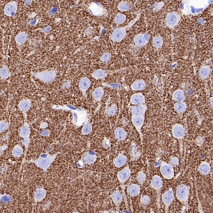 Vesicular Glutamate Transporter 1 (VGLUT1) Recombinant Rabbit mAb (S-1118-58)