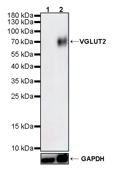 VGLUT2 Recombinant Rabbit mAb (S-4399-14)