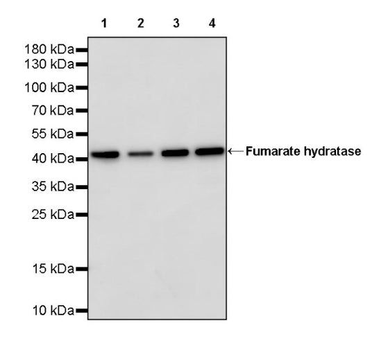 Fumarate hydratase Recombinant Rabbit mAb (SDT-2434-37)