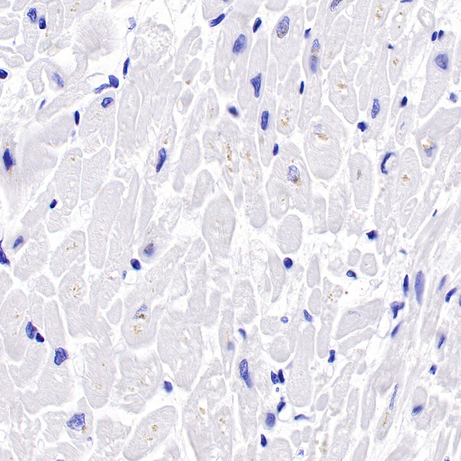 S-RMab® CD16a Recombinant Rabbit mAb,PBS Only (SDT-366-45)