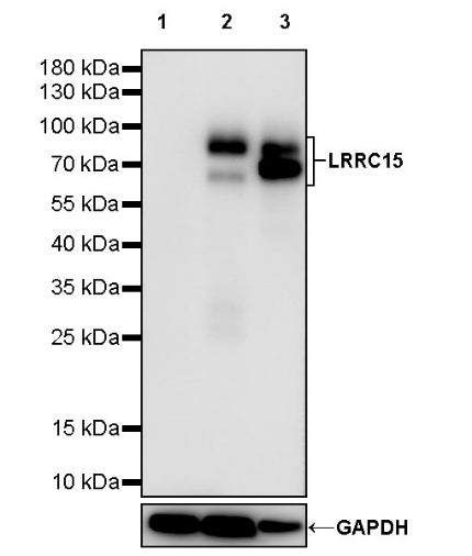 LRRC15 Recombinant Rabbit mAb (S-2473-43)