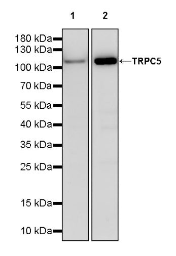 TRPC5 Recombinant Rabbit mAb (S-1901-38)