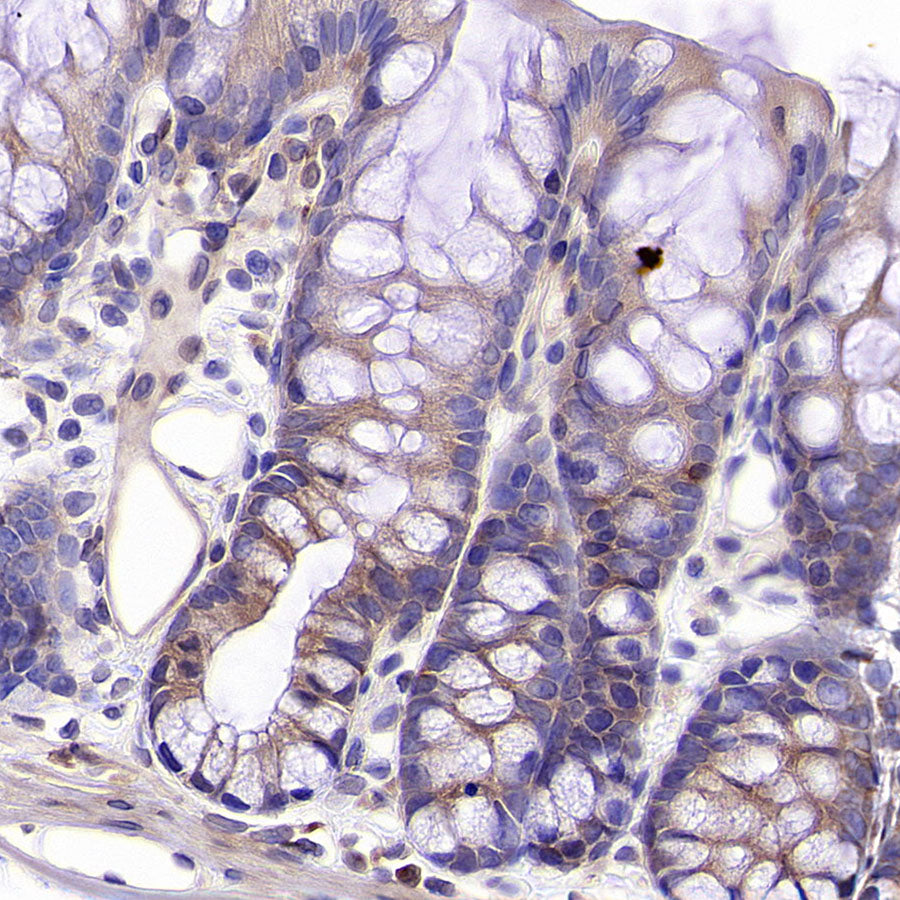 NF-kB p65 Recombinant Rabbit mAb (S-5142)