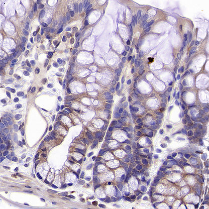 NF-kB p65 Recombinant Rabbit mAb (S-5142)