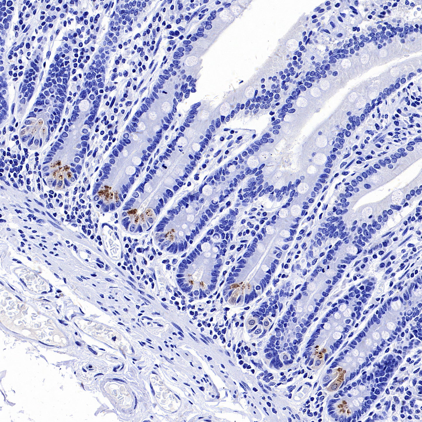 NOD2 Recombinant Rabbit mAb (SDT-3245-112)