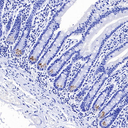 NOD2 Recombinant Rabbit mAb (SDT-3245-112)