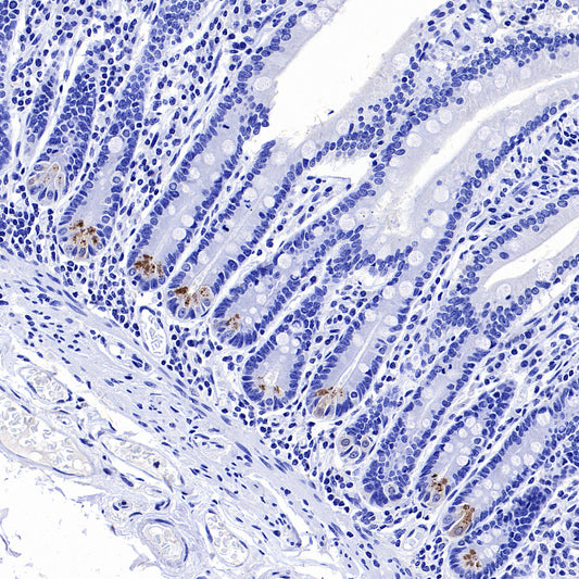 NOD2 Recombinant Rabbit mAb (SDT-3245-112)