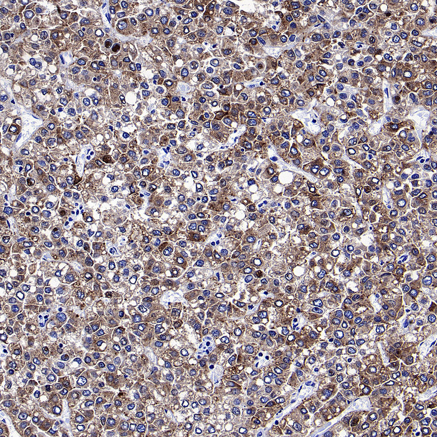 Glypican-3 Recombinant Rabbit mAb (SDT-4064-69-2)