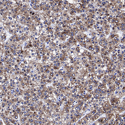 Glypican-3 Recombinant Rabbit mAb (SDT-4064-69-2)