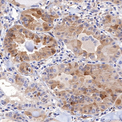 LC3B Recombinant Rabbit mAb (S-477-89)
