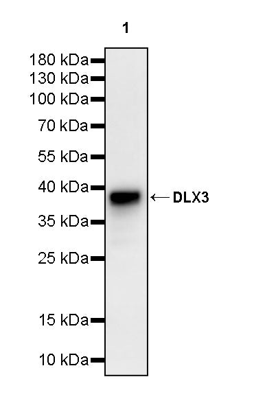 DLX3 Recombinant Rabbit mAb (S-4140-2)