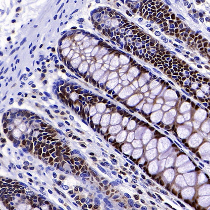 PDCD4 Rabbit polyclonal antibody