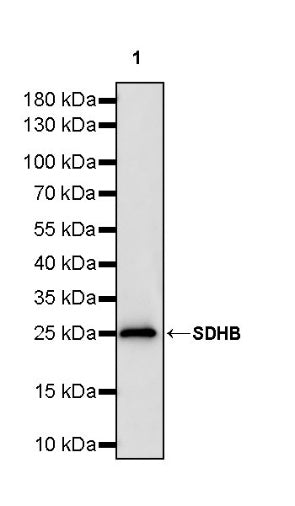SDHB Recombinant Rabbit mAb (SDT-1162-2)