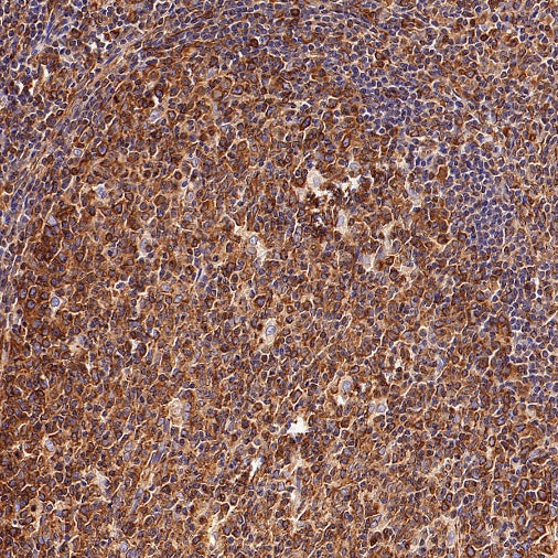 Beta IV Tubulin Rabbit polyclonal antibody
